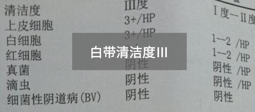 今天快讯！全自动白带樱花草在线社区www中文字幕生产厂家樱花草在线社区www中国中文为您官方解释白带清洁度3的意思