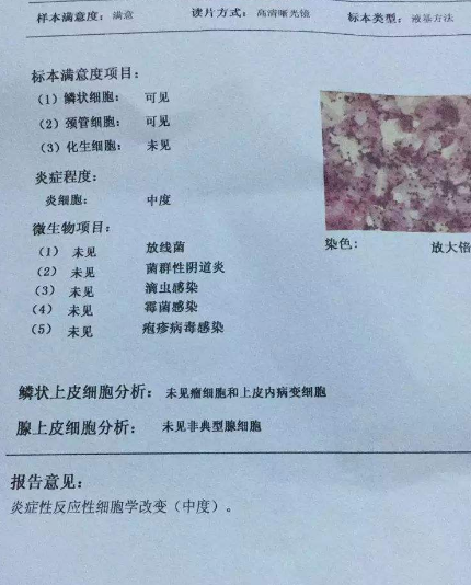 阴道分泌物樱花草视频在线观看高清免费资源厂家教你查看阴道分泌物检测报告