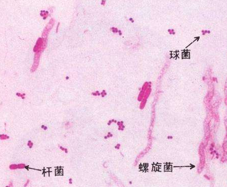 妇科白带樱花草视频在线观看高清免费资源厂家分析白带线索细胞阳性的意义