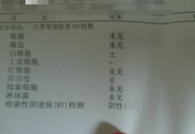 全自动白带樱花草在线社区www中文字幕分享如何看懂白带常规检测报告单